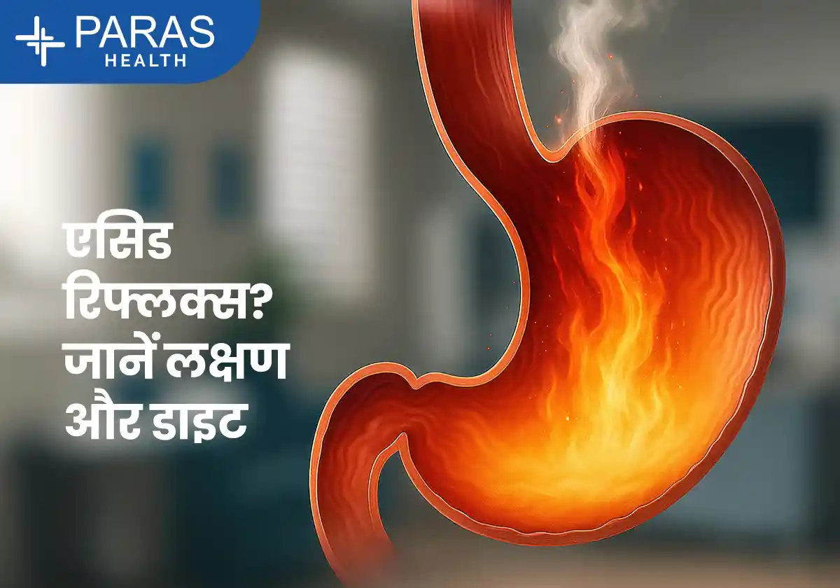 एसिड रिफ्लक्स क्या है? | लक्षण, कारण, इलाज और बचाव
